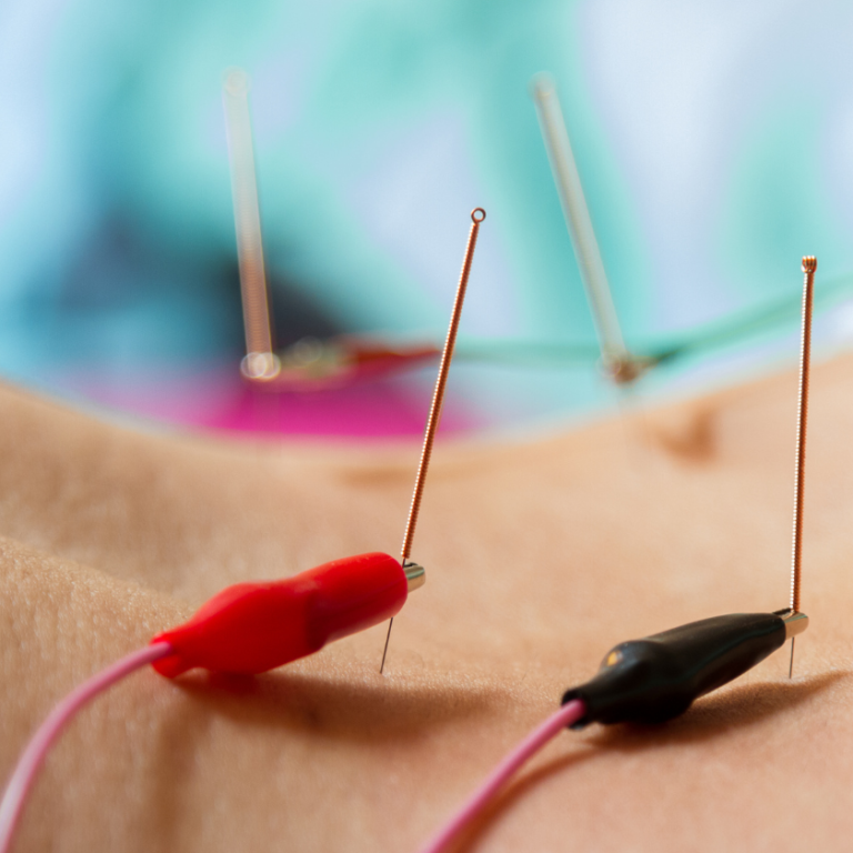 Electro-Acupuncture Services in Orange County