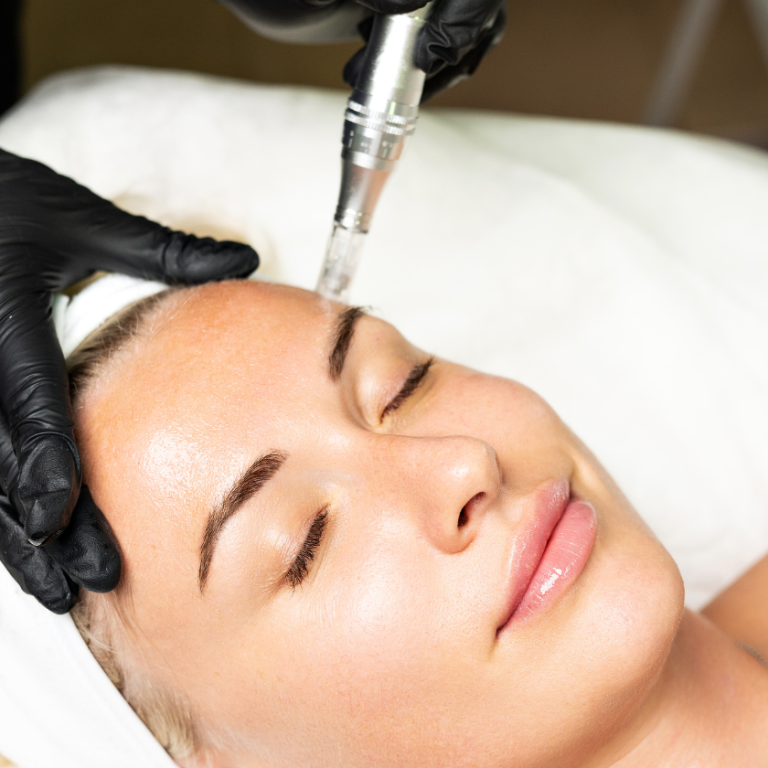 Microneedling Services in Seal Beach